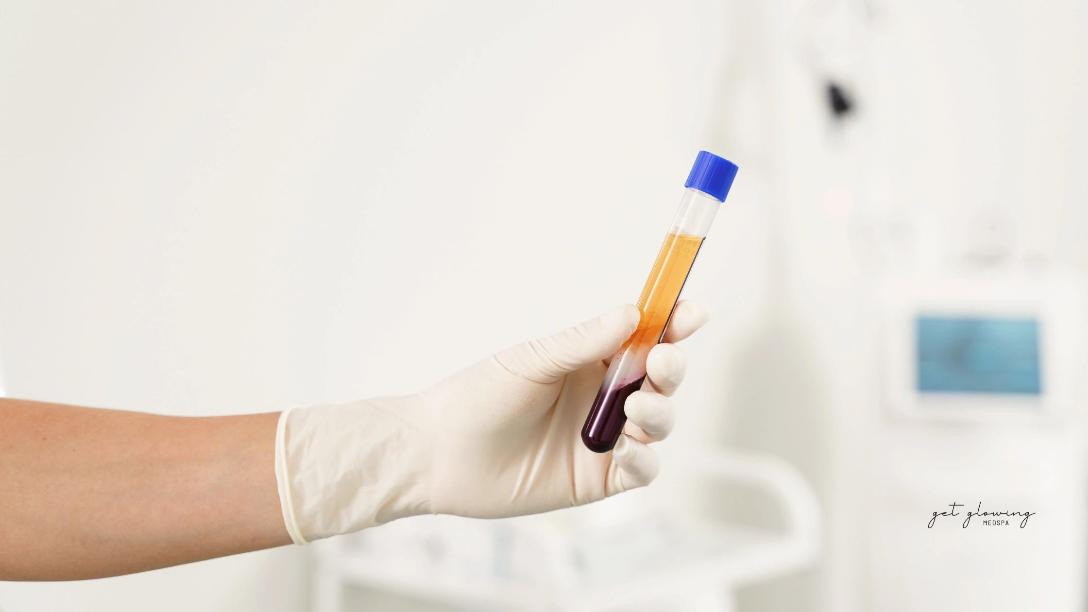 PRP: Your Own Biology as a Treatment