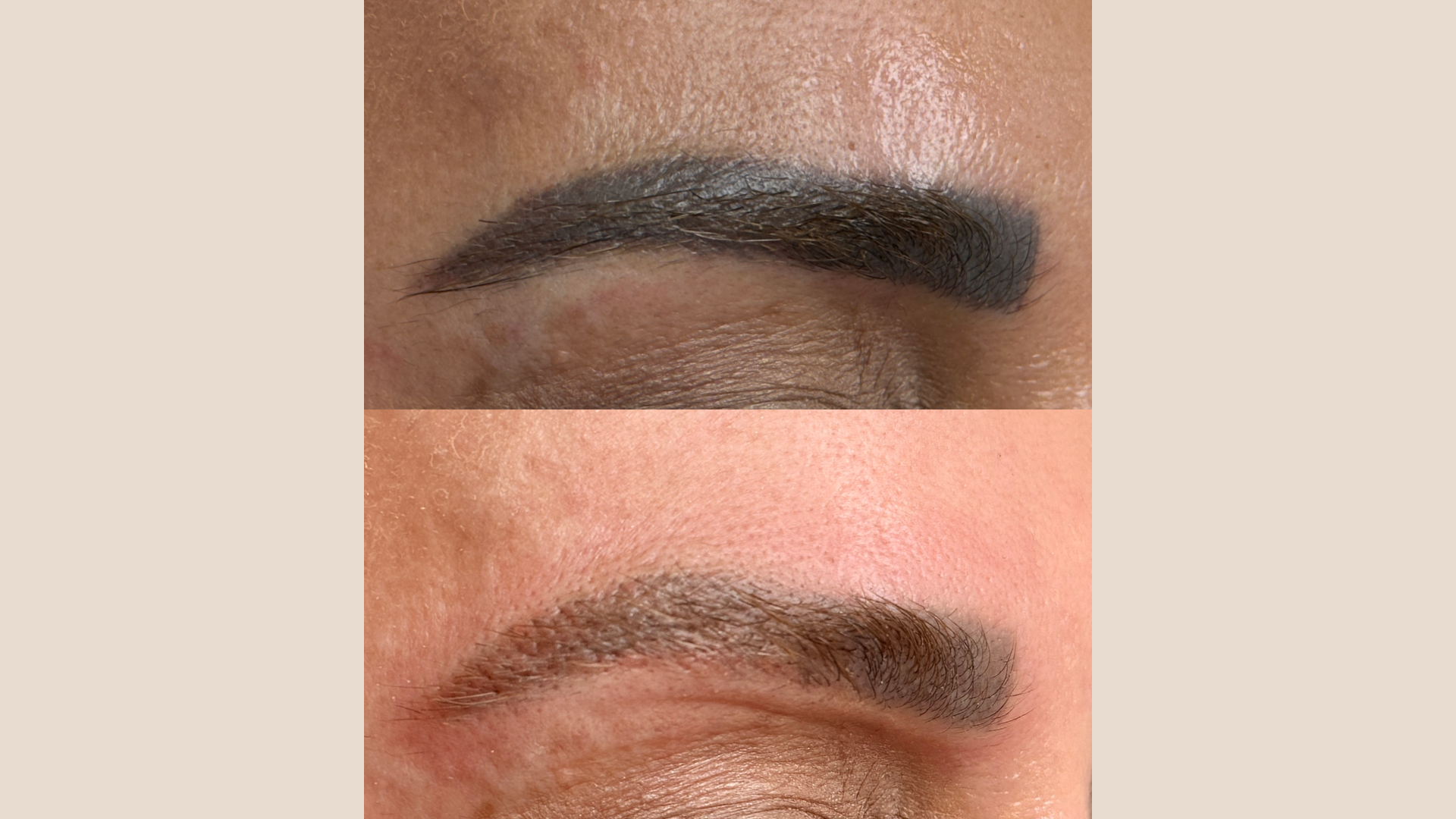 Before and after Cosmetic Brow Removal at Get Glowing MedSpa — dark brow shading noticeably lighter after treatment