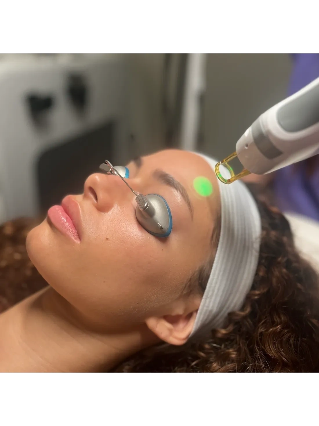 Laser Facial vs Microneedling: Which Treatment Is Better for Your