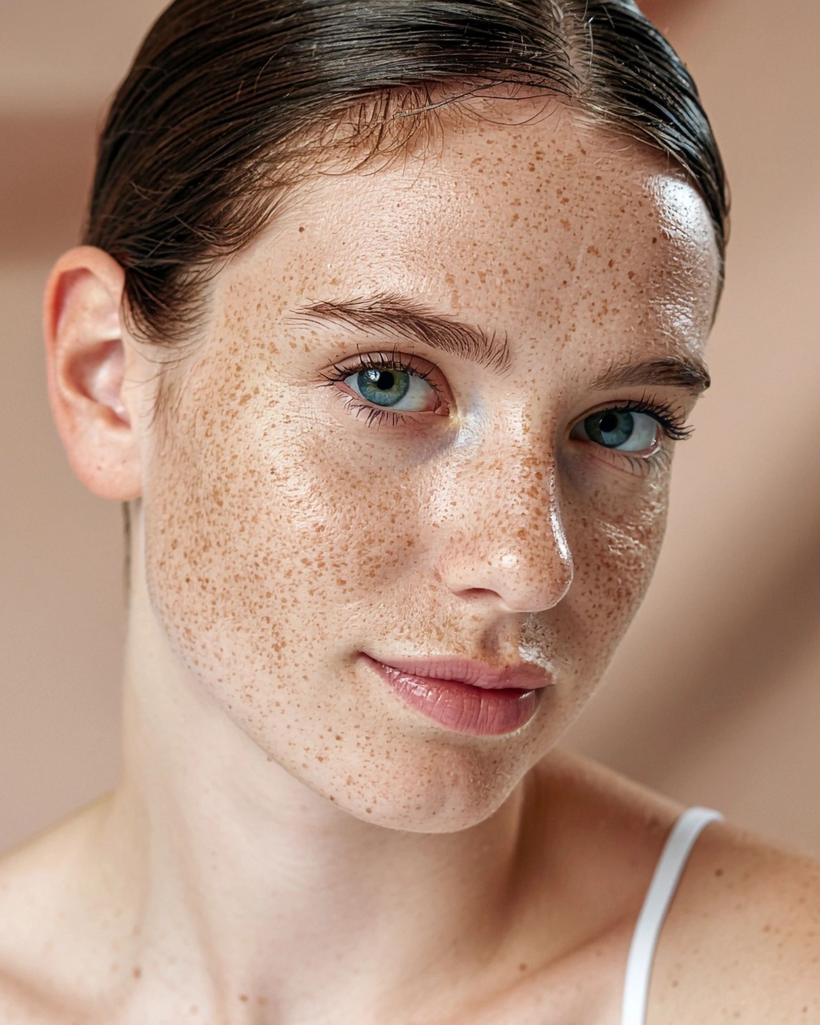 Hyperpigmentation vs Melasma. What's the Difference?