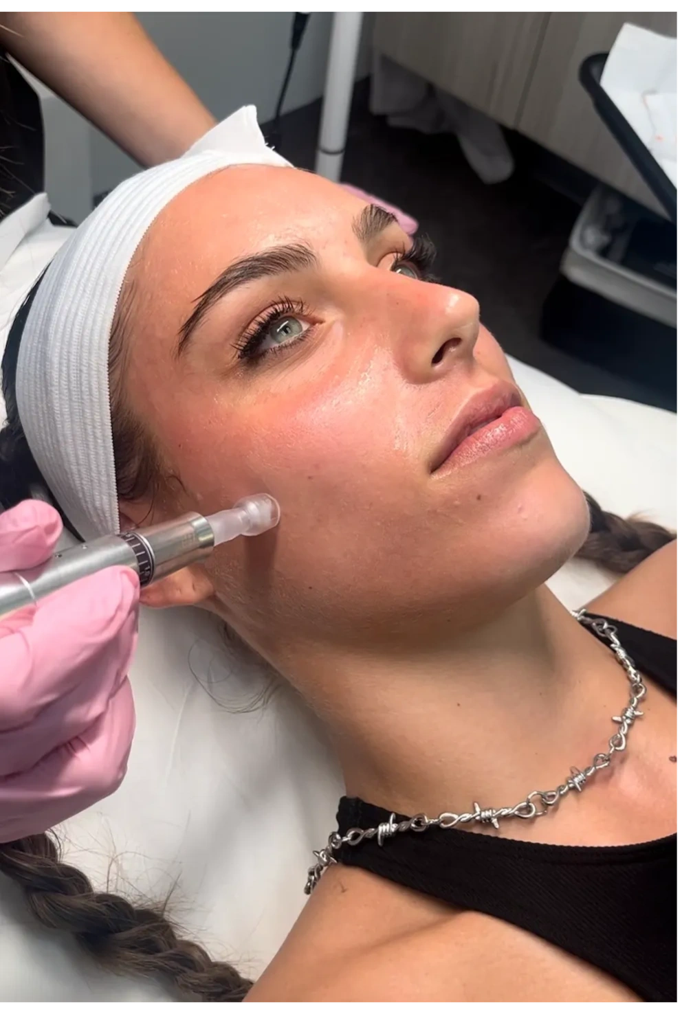 Microneedling with Exosomes: The Gold Standard for Anti-Aging